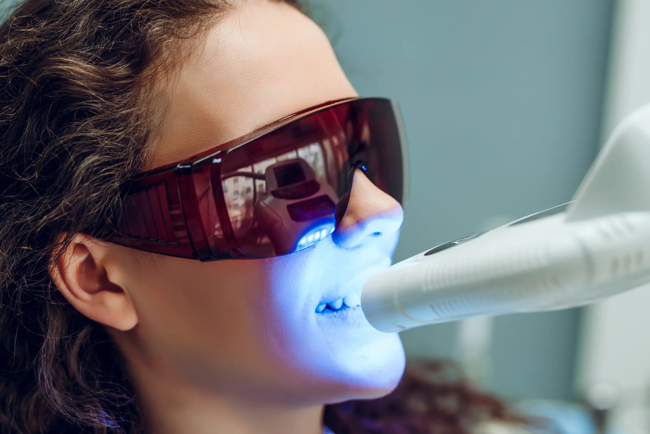 LED Teeth Whitening at Luxe Wellness Spa